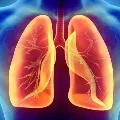 Corona virus damages two lungs in long term as per new research
