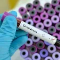 First corona positive case registered in AP