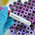 Sweden returned Vijayawada youth tested corona positive