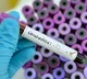 Sweden returned Vijayawada youth tested corona positive