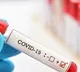 corona cases raised in Tadepalli