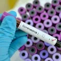 Thousands of corona tests conducted in AP districts