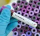 Thousands of corona tests conducted in AP districts