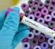 Man tested corona positive in Narayanaguda