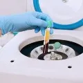 Korean doctors says plasma therapy an alternative treatment for corona patients