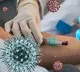 Coronavirus patient treated with plasma therapy in Mumbai dies