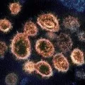 China confess that it says virus first samples to be destroyed