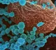 Corona virus cases increases day by day in Andhrapradesh